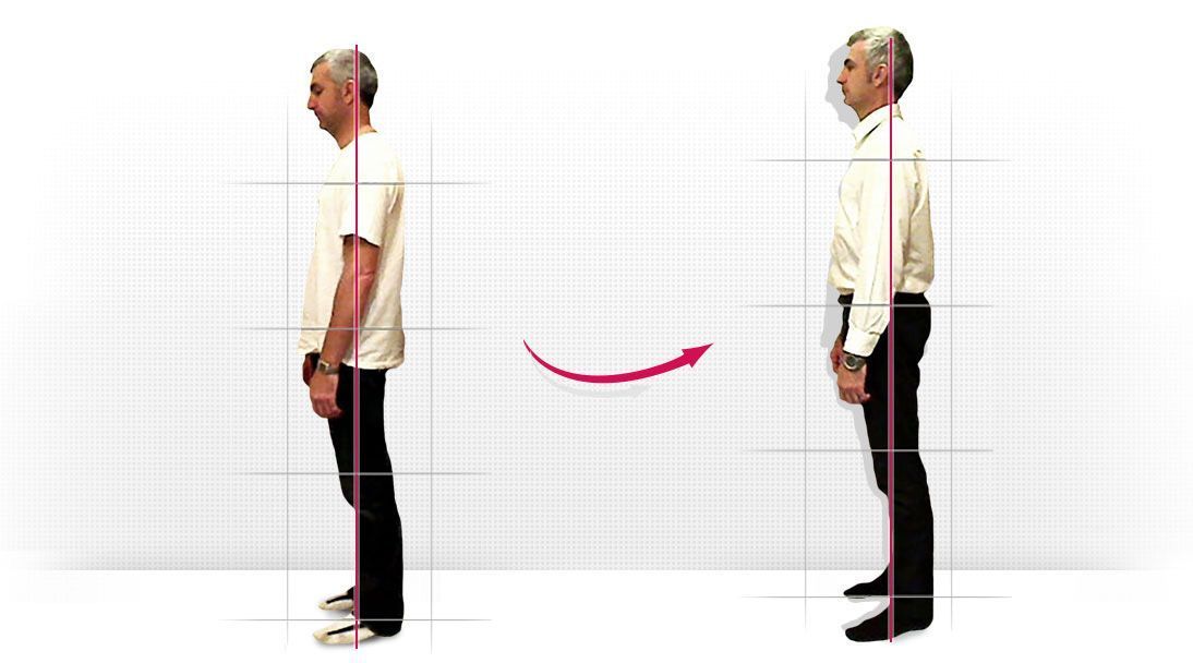 Posture comparison slide 2