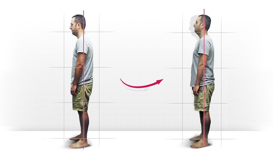 Posture comparison slide 3