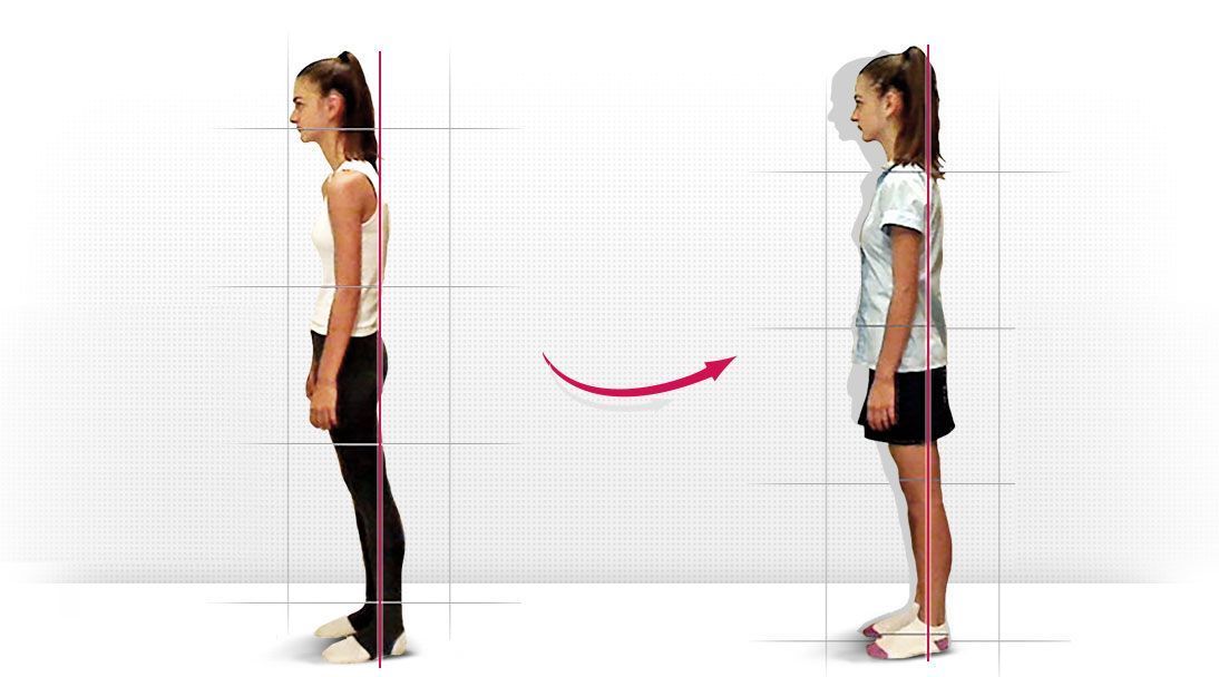 Posture comparison slide 1