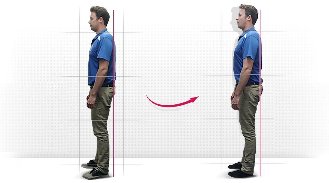 Posture comparison slide 5
