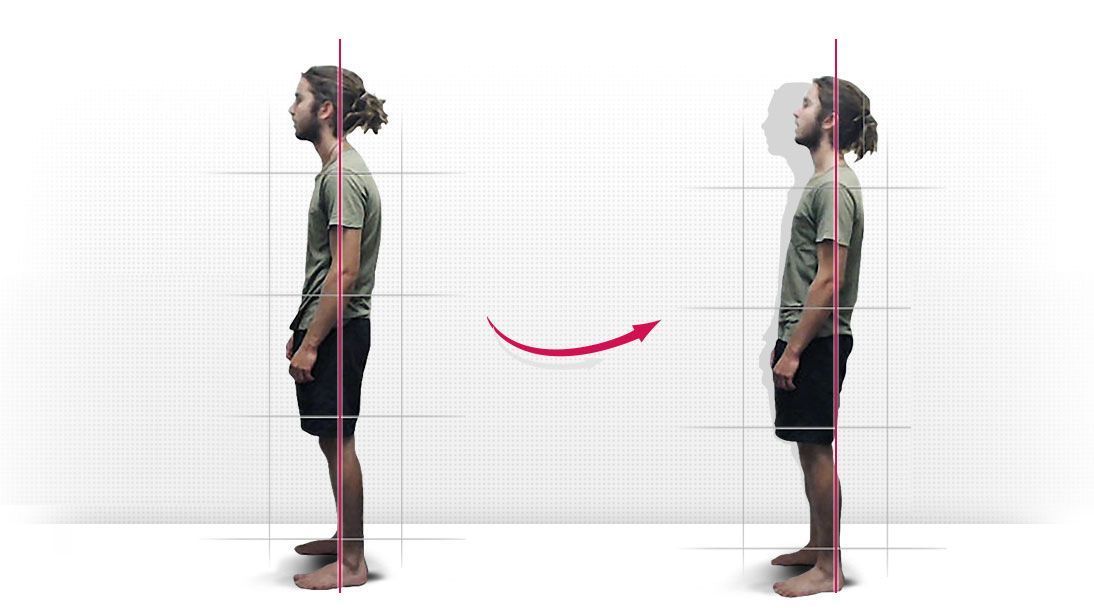 Posture comparison slide 4