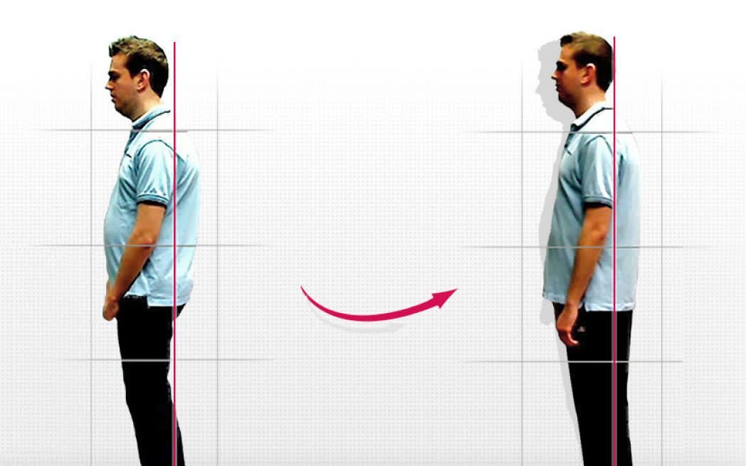 Posture comparison slide 6